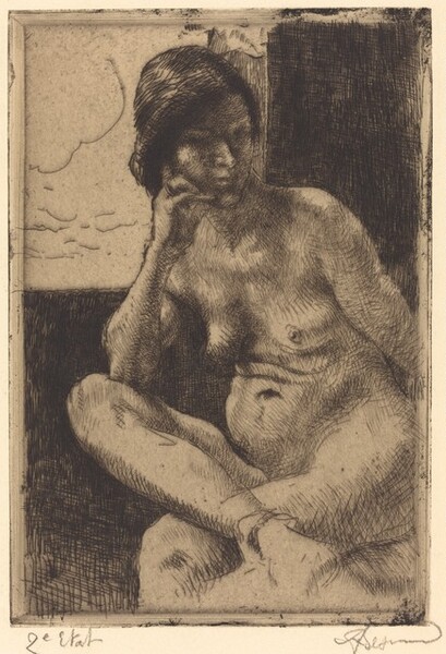 Seated Nude with Her Arm Resting on Her Leg (Femme nue assise, le bras appuyé sur la jambe)
