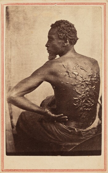 McPherson & Oliver, The Scourged Back, c. 1863