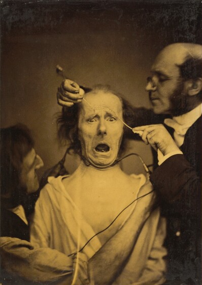 Guillaume-Benjamin-Amant Duchenne (de Boulogne), Terror mixed with pain, torture, 1854-1856, printed 1862
