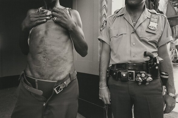 A known drug dealer shows the knife wounds he had received in pursuit of his street trading. In this district the streets are so dangerous that the police officer carries two guns and a switch-blade knife. The small opera glasses are used to watch drug dealers from a distance, New York City