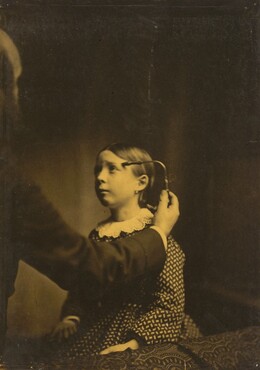 Guillaume-Benjamin-Amant Duchenne (de Boulogne), Painful memories, 1854-1856, printed 1862